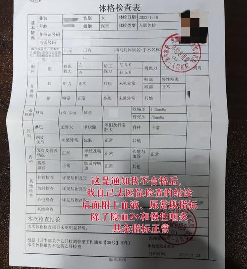 事業(yè)單位體檢什么情況下會(huì)不過(guò)(入職體檢嚴(yán)不嚴(yán))-圖1